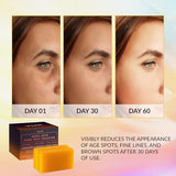 Kojic Acid Dark Spot Remover Soap with Vitamin C, Retinol & Turmeric – Skin Brightening, Anti-Aging, Hydrating Japanese Complex
