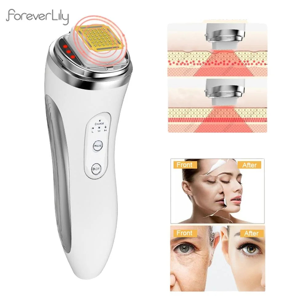 RF Facial Tightening Device – Anti-Aging Wrinkle Remover for Face, Eyes & Neck