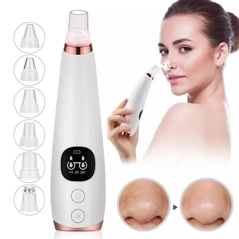 Electric Blackhead Remover Vacuum for Deep Pore Cleansing
