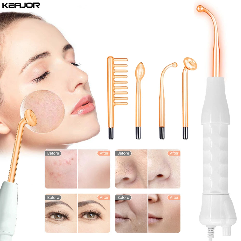 High Frequency Facial Wand for Skin Tightening, Acne Treatment & Anti-Aging