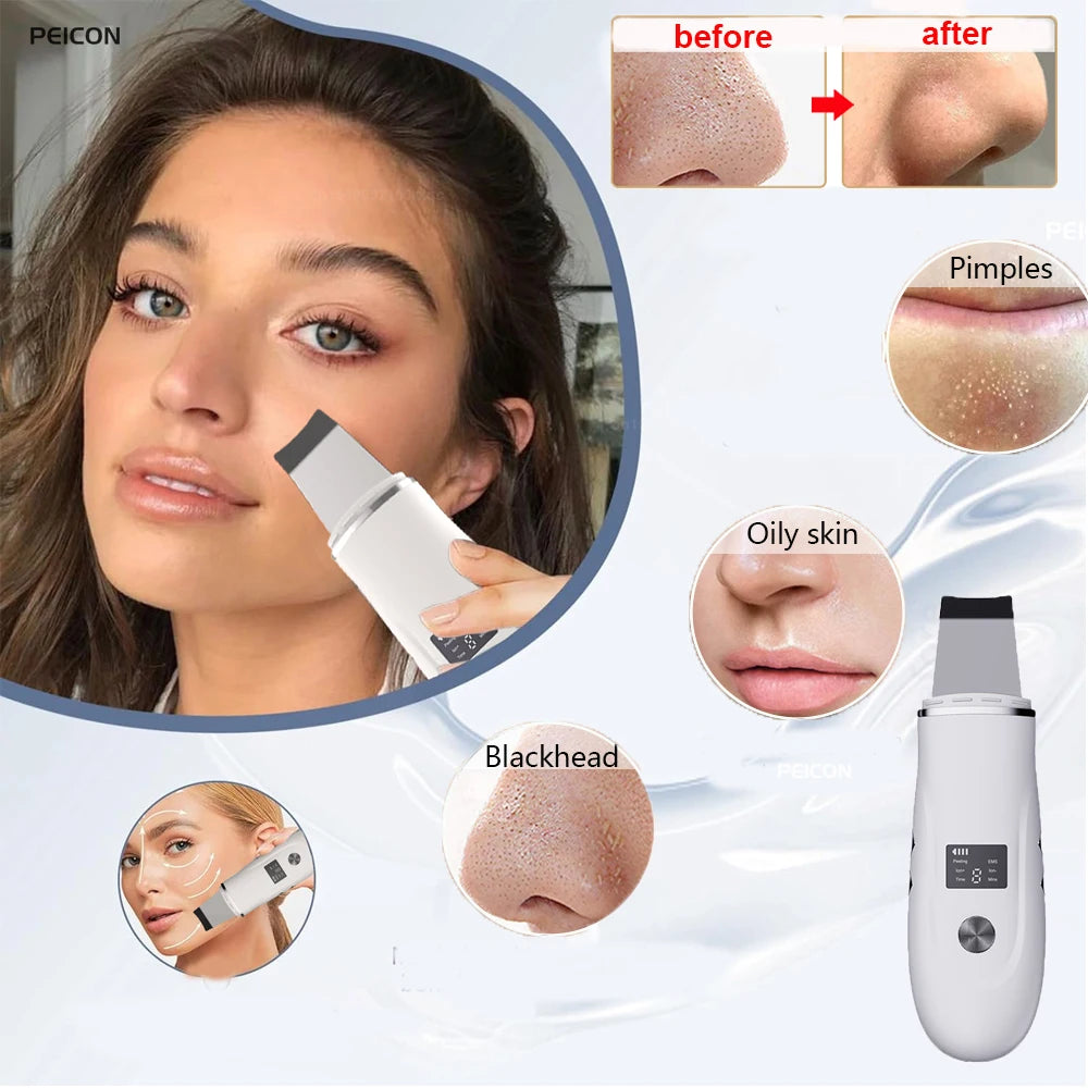 Multifunctional Skin Scrubber & Face Spatula – Deep Clean & Pore Treatment Tool