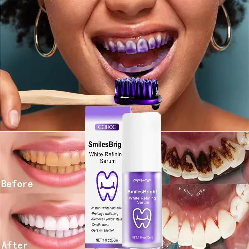 Korean Teeth Whitening Gel - Stain Removing Toothpaste for Fresh Breath & Brighter Smile