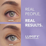 Fast-Acting Redness Relief Eye Drops for Brighter, Whiter-Looking Eyes