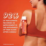Multi-Purpose Skincare Oil for Scars, Stretch Marks & Deep Hydration