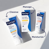 Maximum Strength Benzoyl Peroxide Acne Foaming Cleanser for Clear Skin