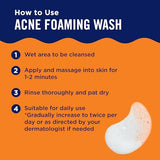 Maximum Strength Benzoyl Peroxide Acne Foaming Cleanser for Clear Skin