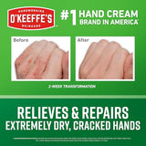 Intensive Hand Repair Cream for Cracked, Dry Skin with Long-Lasting Moisture Protection