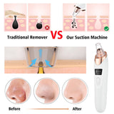 Rechargeable Electric Blackhead Remover with Vacuum Suction & Blue Light Therapy