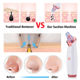 Rechargeable Blackhead Remover Vacuum with 5 Suction Heads & Adjustable Power Levels