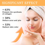 Glycolic Acid 7% Toner for Acne Treatment & Skin Rejuvenation