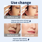 LED Light Therapy Mask for Skin Rejuvenation, Anti-Acne, Anti-Wrinkle & Whitening