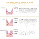 No-Needle RF Skin Rejuvenation Device for Face and Body Tightening