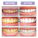 Instant Teeth Whitening Paint Kit - Remove Stains & Brighten Smile in 30 Seconds