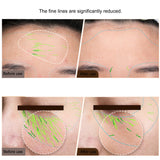 Professional RF & EMS Facial Machine – Skin Tightening & Anti-Aging Device for Face and Body