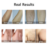 Professional IPL Hair Removal Device - 999,999 Flashes for Permanent Painless Hair Removal