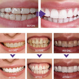 Korean Teeth Whitening Gel - Stain Removing Toothpaste for Fresh Breath & Brighter Smile