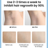 Professional IPL Laser Hair Removal Device with Ice Cooling Technology – 400,000 Flashes Permanent Hair Remover