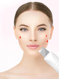 Ultrasonic Facial Skin Scrubber – Deep Cleansing &amp; Exfoliating Pore Cleaner