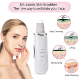 Ultrasonic Facial Skin Scrubber – Deep Cleansing &amp; Exfoliating Pore Cleaner
