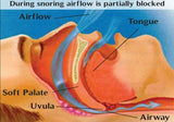 Anti-Snore Nose Clip for Snoring & Sleep Apnea Relief