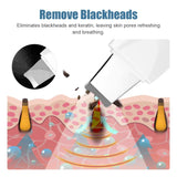 Ultrasonic Skin Scrubber & Blackhead Remover with Ion Deep Pore Cleaner