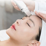 Ultrasonic Facial Skin Scrubber – Deep Cleansing &amp; Exfoliating Pore Cleaner