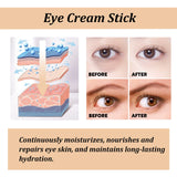 Snail Essence Eye Cream Stick – Anti-Aging, Dark Circle & Puffiness Treatment
