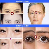 Radio Frequency RF Beauty Machine for Face Lifting, Skin Rejuvenation & Body Slimming