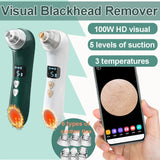 Electric Blackhead Remover & Pore Cleaner – Heated Facial Skin Care Tool for Acne and Dead Skin Removal