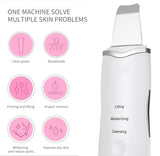 Ultrasonic Facial Skin Scrubber – Deep Cleansing &amp; Exfoliating Pore Cleaner