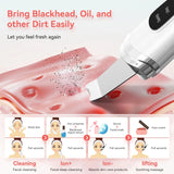 Ultrasonic Facial Skin Scrubber – Deep Pore Cleaner, Blackhead Remover & Anti-Acne Device