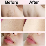 Rechargeable Women's Hair Removal Epilator – 2-in-1 Electric Shaver for Face & Body