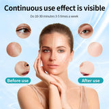 LED Light Therapy Mask for Skin Rejuvenation, Anti-Acne, Anti-Wrinkle & Whitening