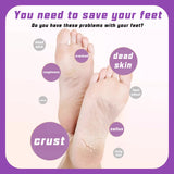 Professional Electric Callus Remover – USB Rechargeable with 60 Replacement Sandpaper Trays